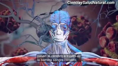 SOBREDOSIS DE ALUMINIO EN VACUNAS