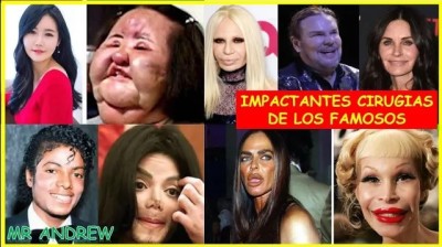 IMPACTANTES cirugias extremas que DEFORMARON por completo  a los FAMOSOS - Mister Andrew